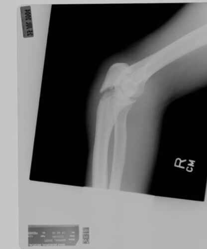 The Sport of Communicating Injuries
